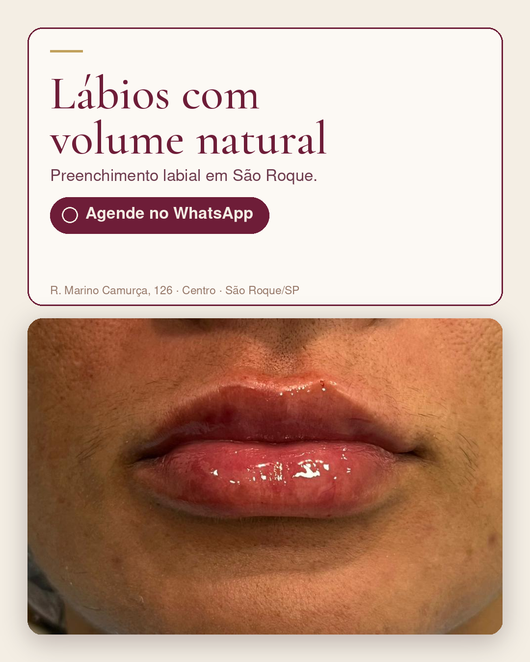 Lábios com volume natural